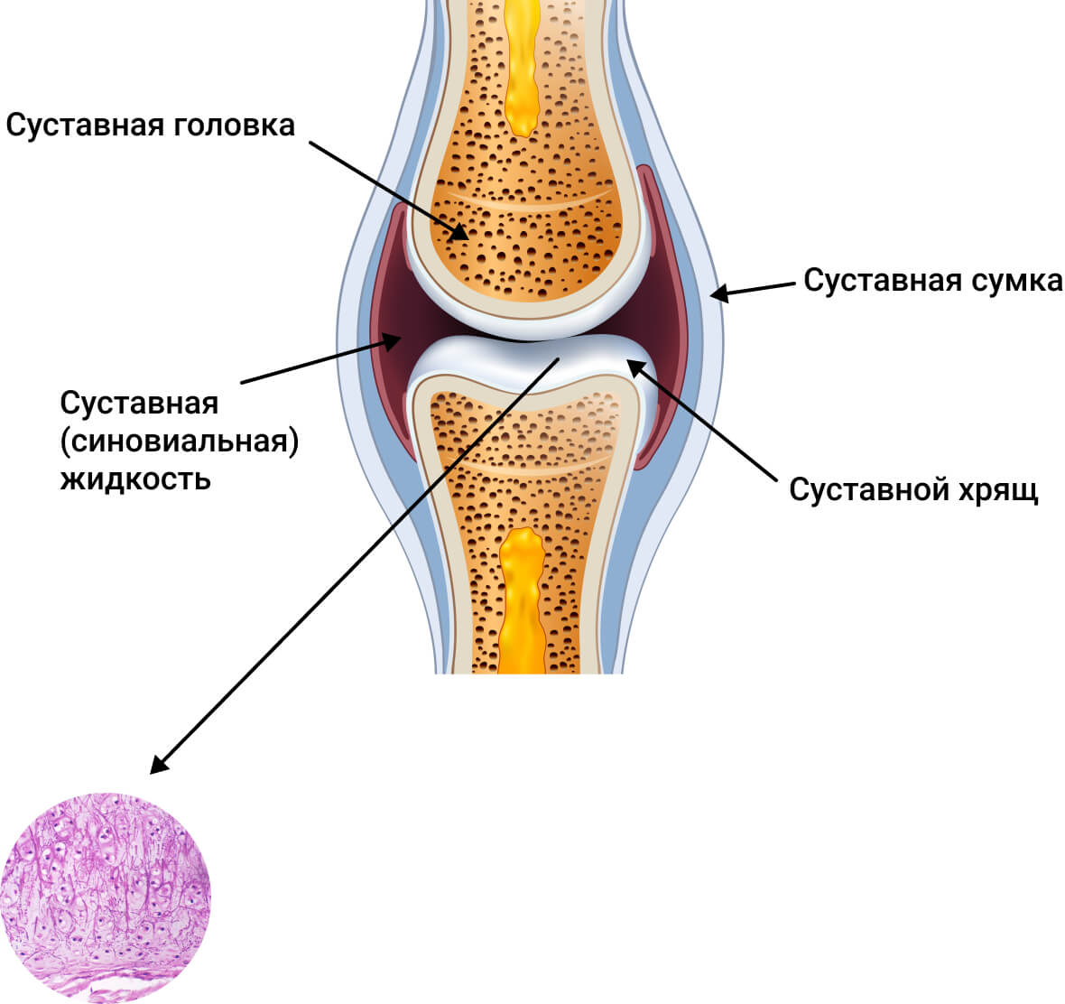 Устройство сустава